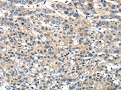 DNAJA3 Antibody