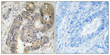 Phospho-CAD (Thr456) Antibody