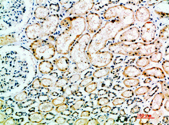 ACE Antibody