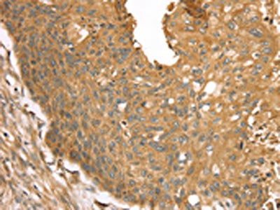 STX16 Antibody