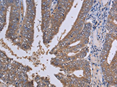 LIMS1 Antibody