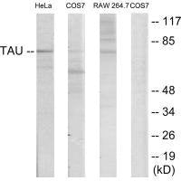 MAPT (Ab-235) Antibody