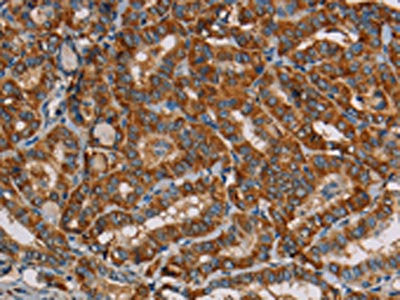 MRPL39 Antibody