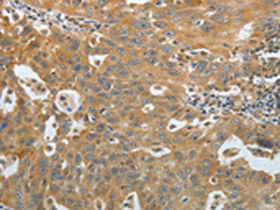 AMPH Antibody