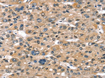 SULT1B1 Antibody