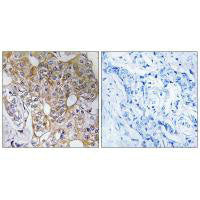 CCT6A Antibody