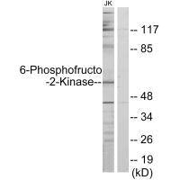 PFKFB2 Antibody