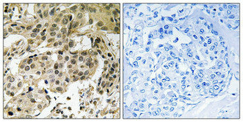 Phospho-CBX5 (Ser92) Antibody