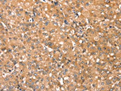 RPS6KA1 Antibody