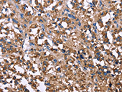 SERPINA1 Antibody