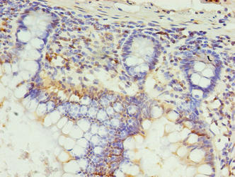 SETX Antibody