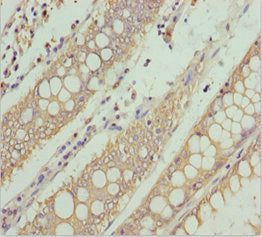 NEK8 Antibody