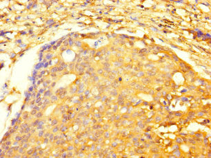 TRIM74 Antibody