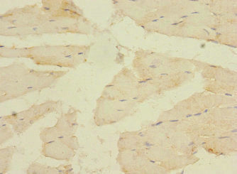 CACNA2D4 Antibody