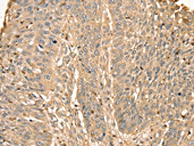 S100A12 Antibody