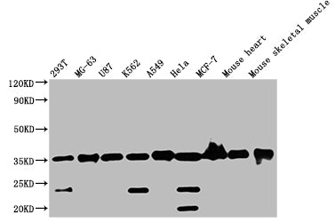 ANKRD23 Antibody