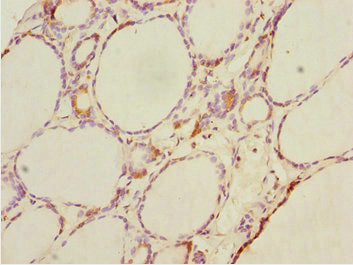 DTX2 Antibody