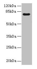 TTC30A Antibody