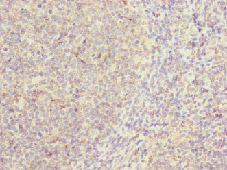 CAMSAP2 Antibody