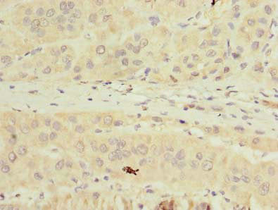 TMPRSS6 Antibody