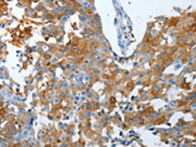 LOX Antibody