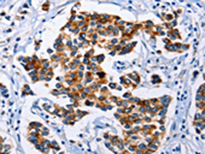 SERPINA3 Antibody