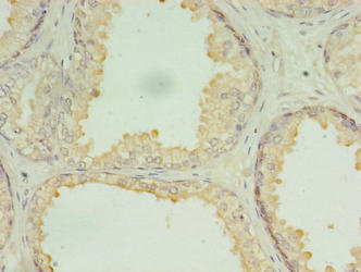 DRC7 Antibody