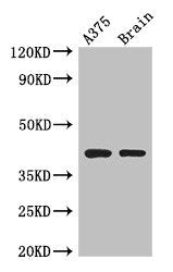 SEPT12 Antibody
