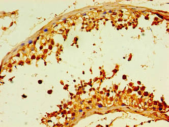 DCP2 Antibody
