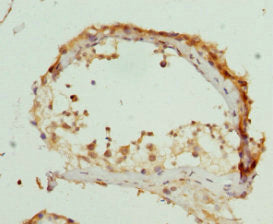 ZDHHC17 Antibody