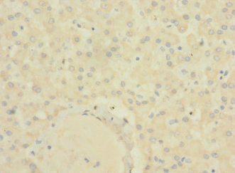 SLC22A9 Antibody