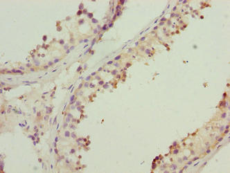 MRPL41 Antibody