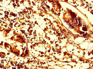 SMAP1 Antibody