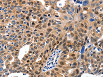 MCM7 Antibody