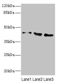 CAMK1D Antibody