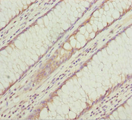 KLHL7 Antibody