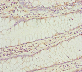 KLHL7 Antibody