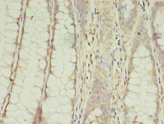CPNE9 Antibody