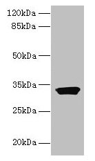 ODF3L1 Antibody