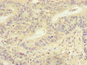 FMNL3 Antibody