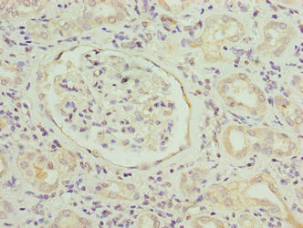 SLITRK4 Antibody