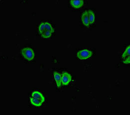 NALCN Antibody