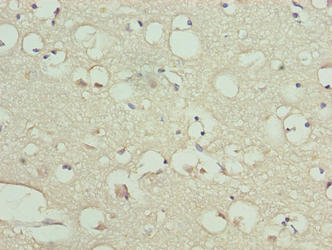 KIAA0319L Antibody