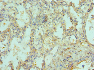SIAH1 Antibody
