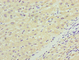 NKAIN4 Antibody