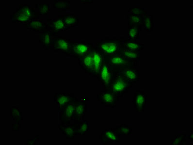MAPKAPK5 Antibody