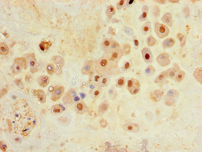 SLC30A8 Antibody