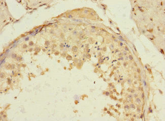 TIGD4 Antibody