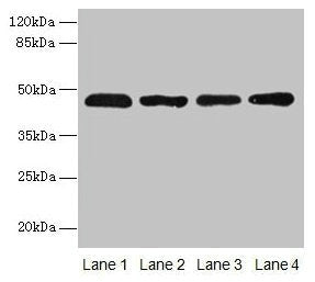 ZDHHC23 Antibody