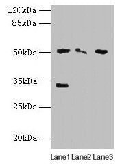 SLC38A6 Antibody